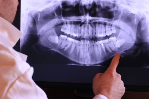 Best Emergency Root Canal Treatment in Scarsdale, NY