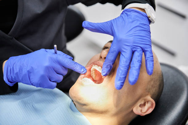 Best Emergency Dental Care for Abscessed Tooth in Scarsdale, NY
